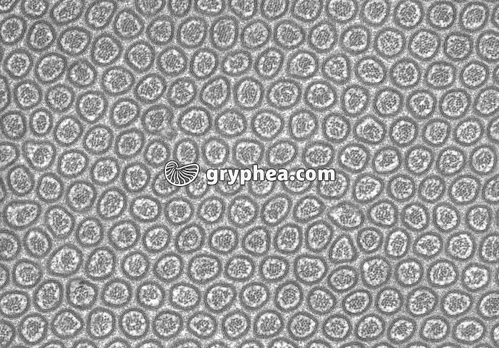 Microvillosités intestinales CT MET x35000 - gryphea.com